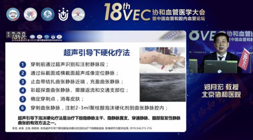 聚桂醇微創(chuàng)硬化治療技術(shù)學(xué)術(shù)推廣會(huì)六會(huì)同開(kāi)，軟件助力數(shù)字化診療